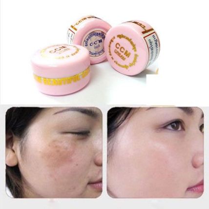 Trị nám Thái Lan - 4 loại kem được người Việt mua nhiều nhất kem trị nám Thái Lan CCM