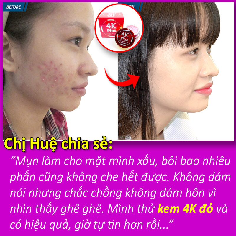 Kem 4K Plus đỏ có phải kem trộn không? Cách phân biệt chính xác nhất Kem 4K Plus đỏ có phải kem trộn không