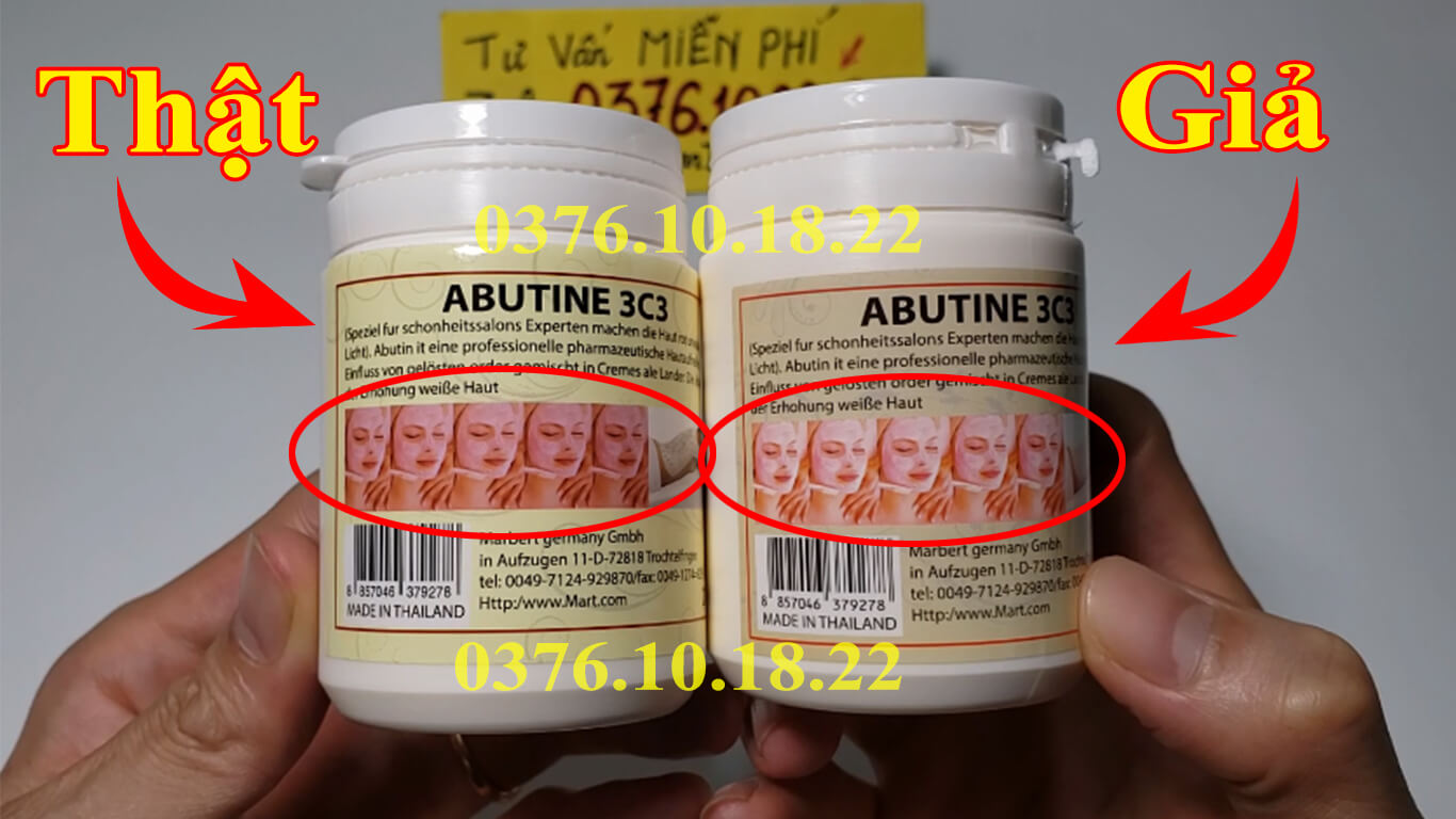 Bột kích trắng Abutine 3C3 có tốt không? Dạng kem hay bột tốt hơn? Bột kích trắng Abutine 3C3 có tốt không Dạng kem hay bột tốt hơn